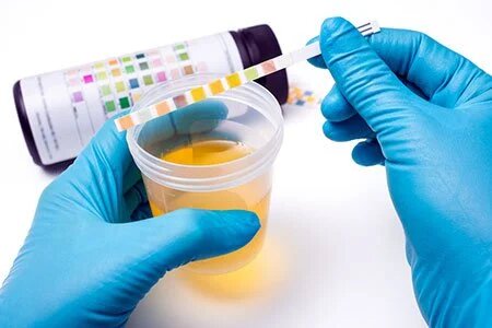 Preventive Health Screening
